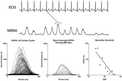 Inter-individual Relationships between Sympathetic Arterial Baroreflex Function and Cerebral Perfusion Control in Healthy Males